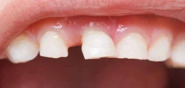 افتادن عاج در خواب