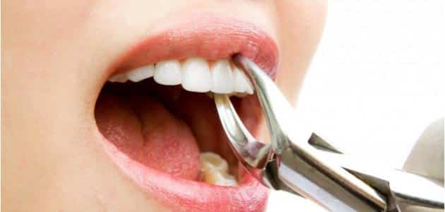 برای برداشتن دندان آسیاب در خواب برای یک زن متاهل