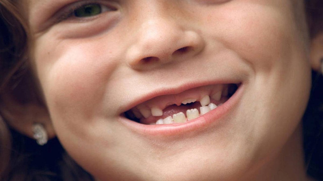 چرا رویای کشیدن دندان را می بینید؟